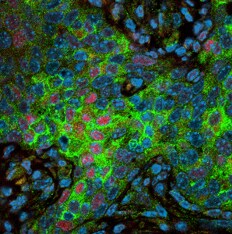 Mouse PD-L1/B7-H1 Antibody AF1019