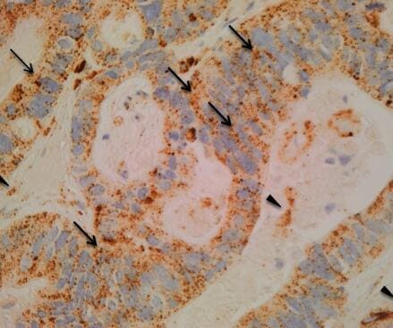 Mouse Cathepsin D Antibody AF1029