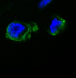 Human ADAM8 Ectodomain Antibody AF1031