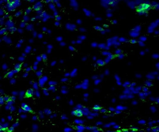 Human Phospho-MSK1 (S212) Antibody AF1036