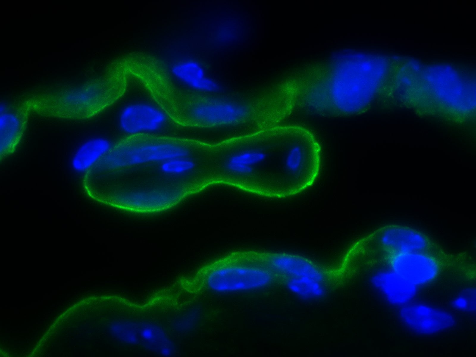 Mouse PDGF R beta  Antibody AF1042