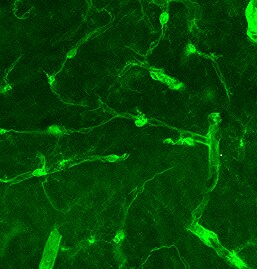Mouse PDGF R beta  Antibody AF1042