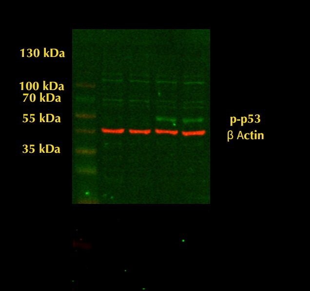 Human Phospho-p53 (S15) Antibody AF1043
