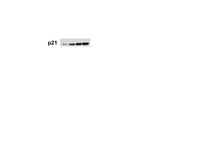 Human p21/CIP1/CDKN1A Antibody AF1047