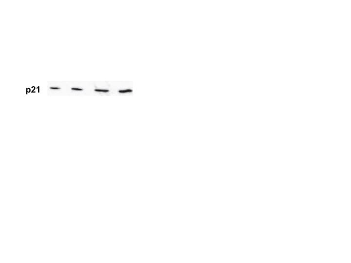 Human p21/CIP1/CDKN1A Antibody AF1047