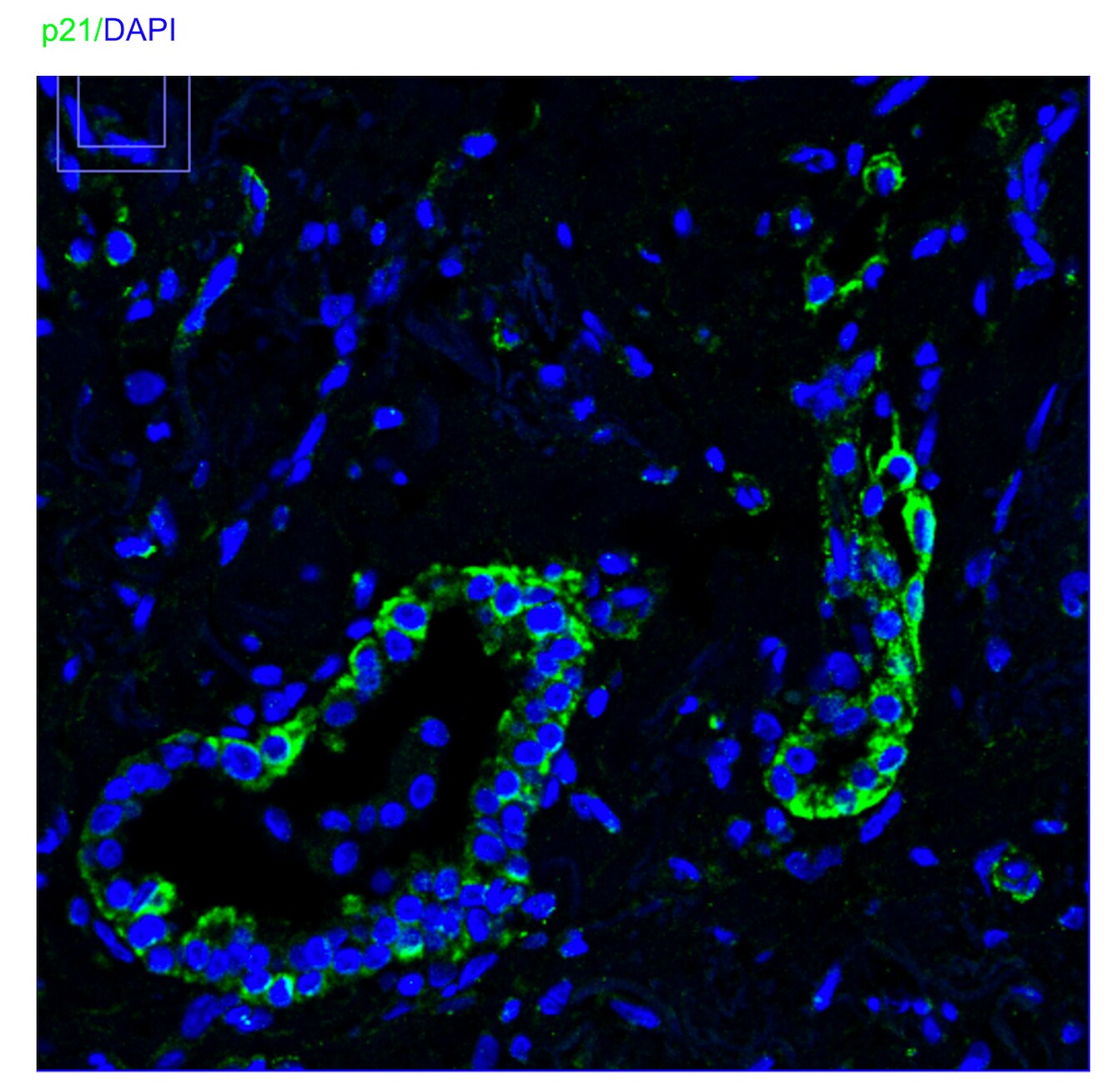 Human p21/CIP1/CDKN1A Antibody AF1047