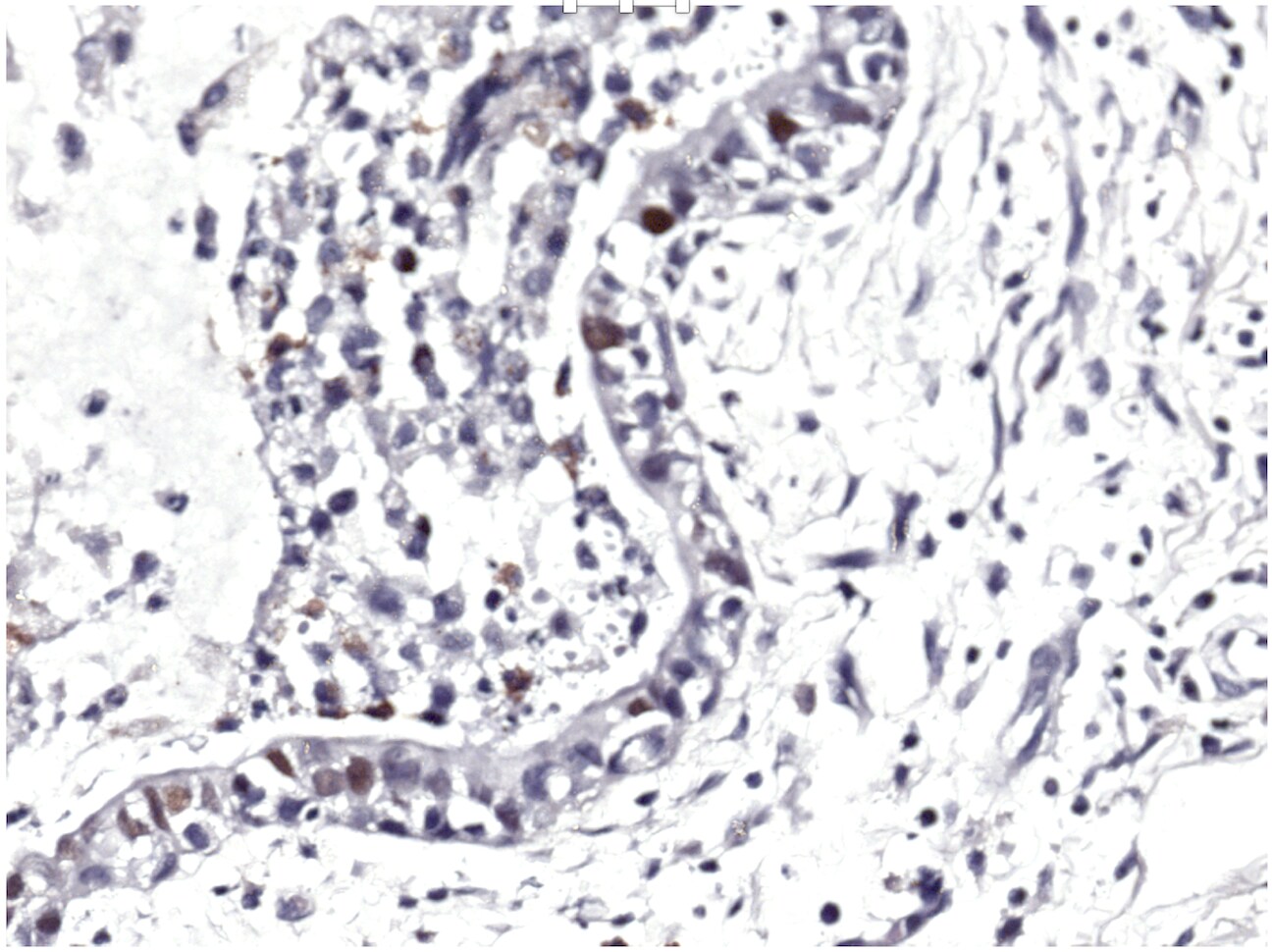Human p21/CIP1/CDKN1A Antibody AF1047