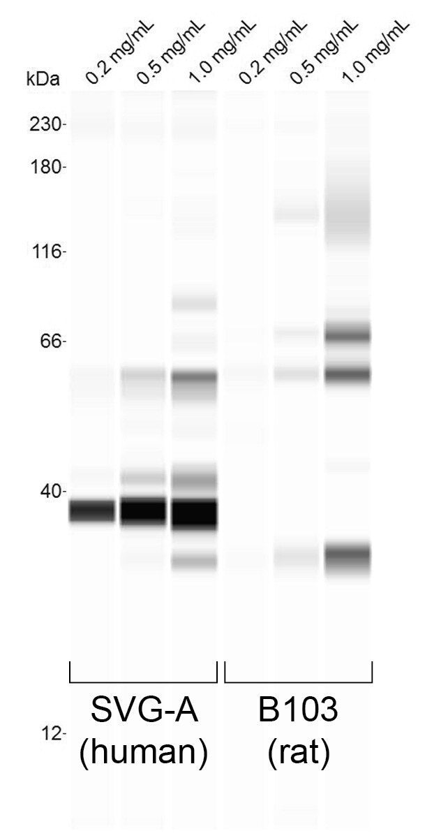 Human Cathepsin A/Lysosomal Carboxypeptidase A Antibody AF1049