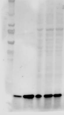 Human EN‑RAGE/S100A12 Antibody AF1052
