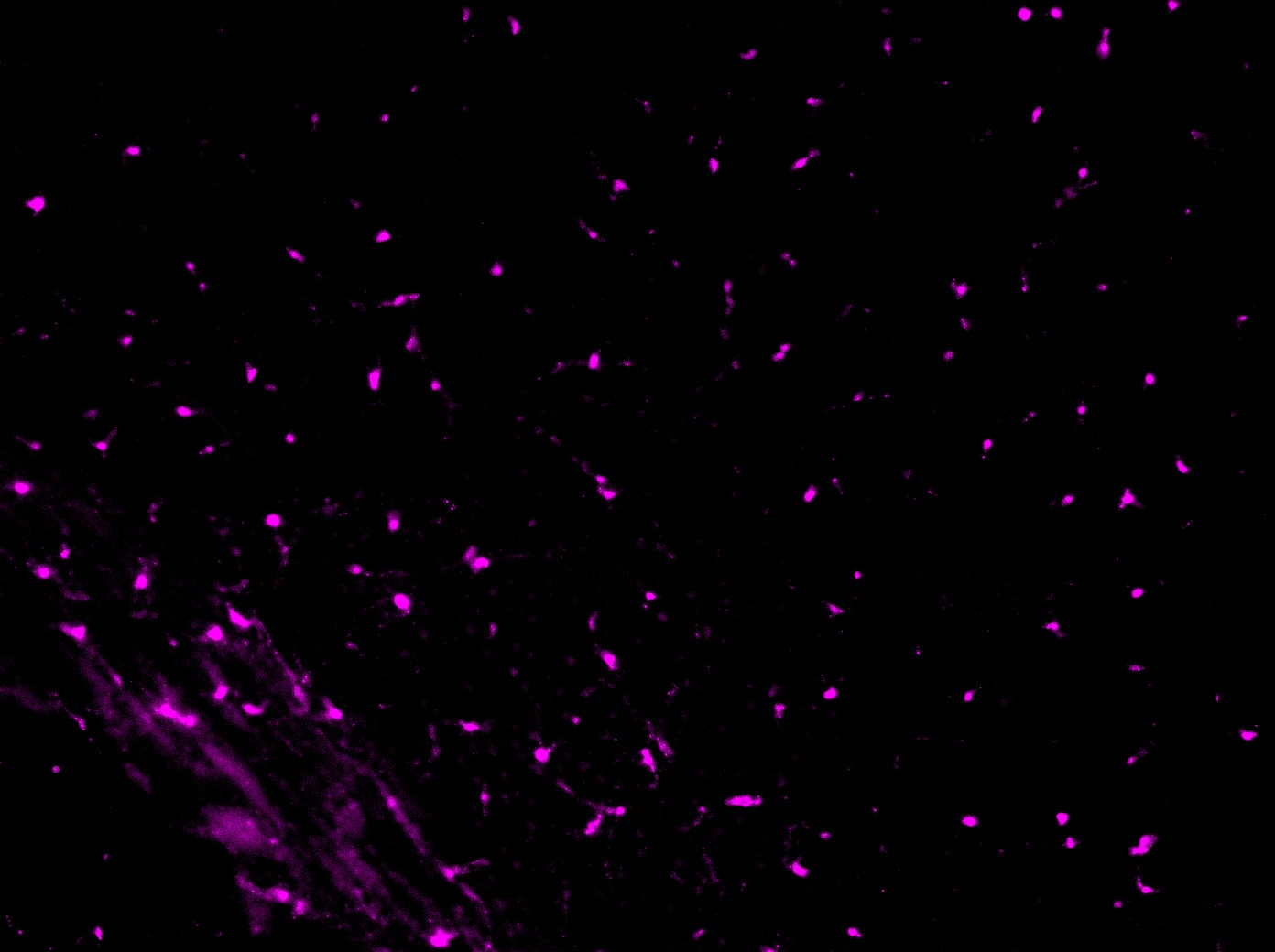 Mouse PDGF R alpha  Antibody AF1062