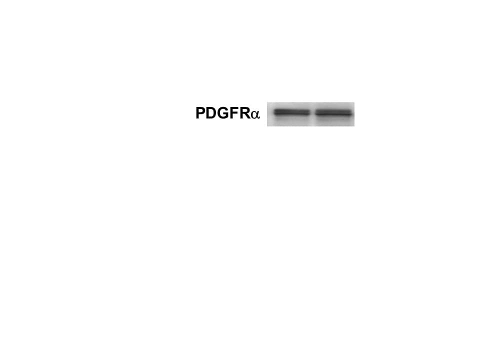 Mouse PDGF R alpha  Antibody AF1062