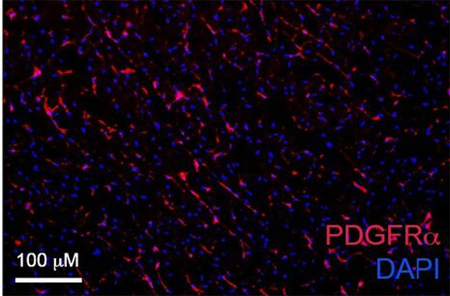 Mouse PDGF R alpha  Antibody AF1062