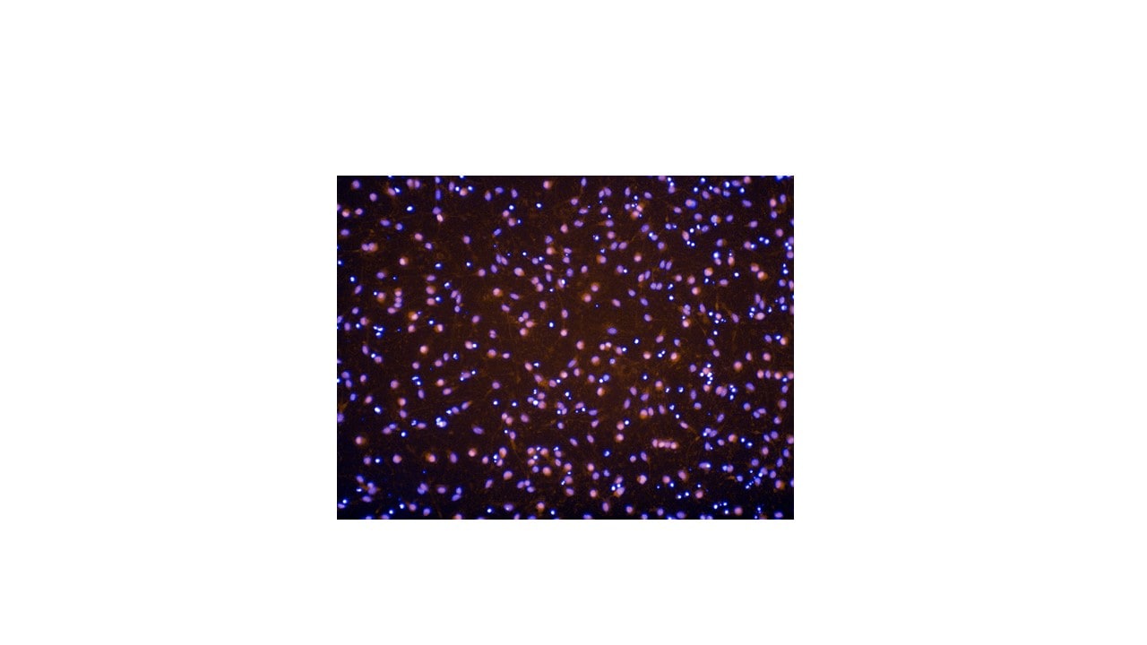 Mouse PDGF R alpha  Antibody AF1062