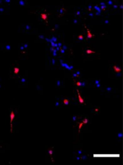 Mouse PDGF R alpha  Antibody AF1062