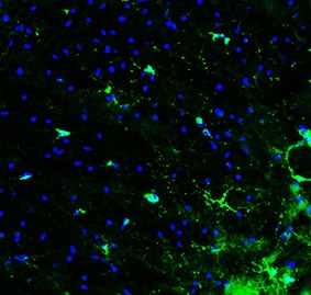 Mouse PDGF R alpha  Antibody AF1062
