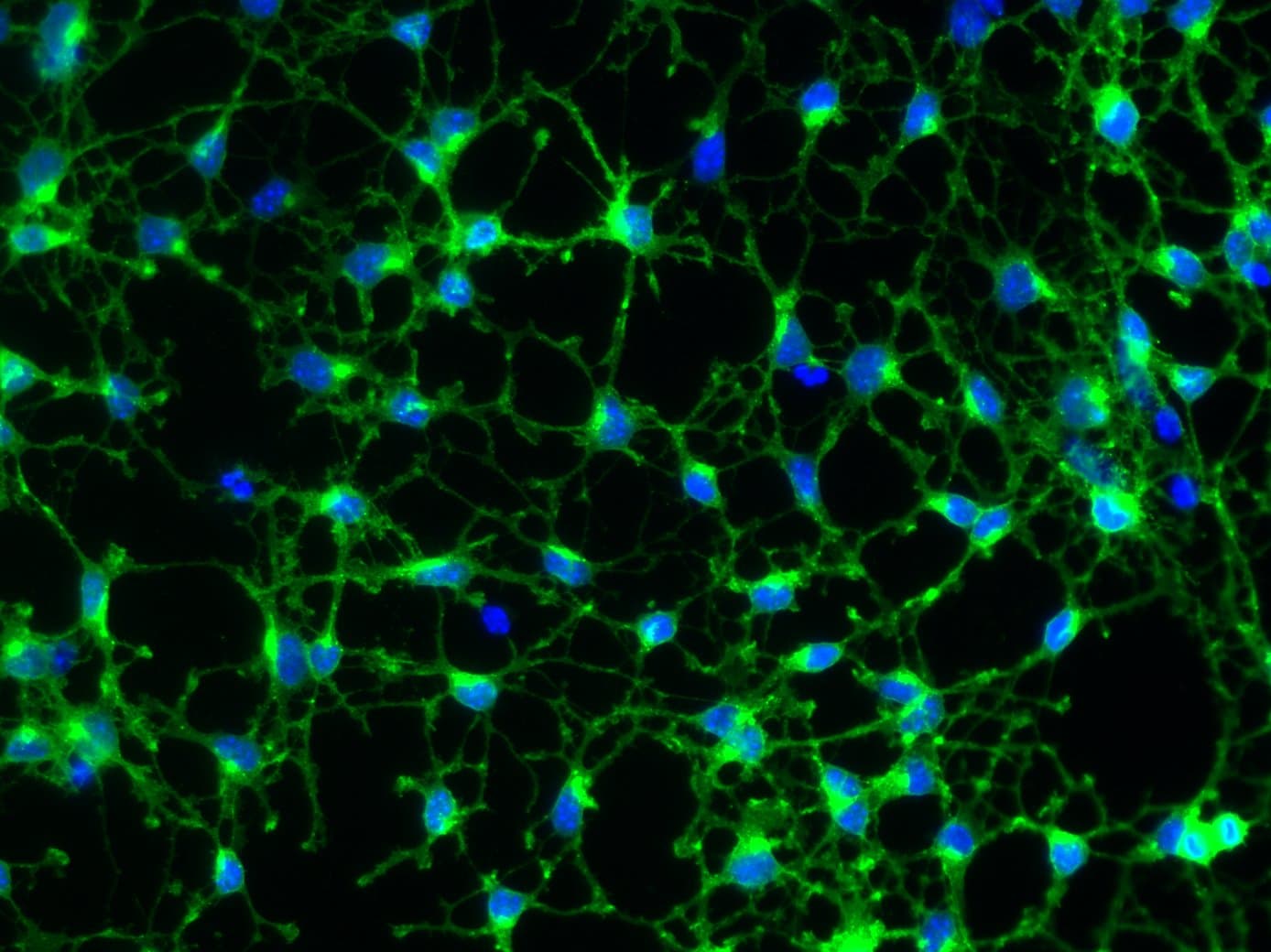 Mouse PDGF R alpha  Antibody AF1062