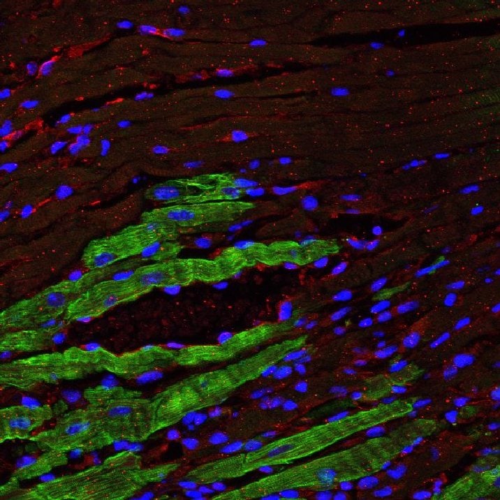 Mouse PDGF R alpha  Antibody AF1062