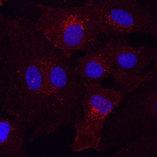 Mouse PDGF R alpha  Antibody AF1062