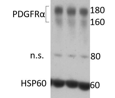Mouse PDGF R alpha  Antibody AF1062