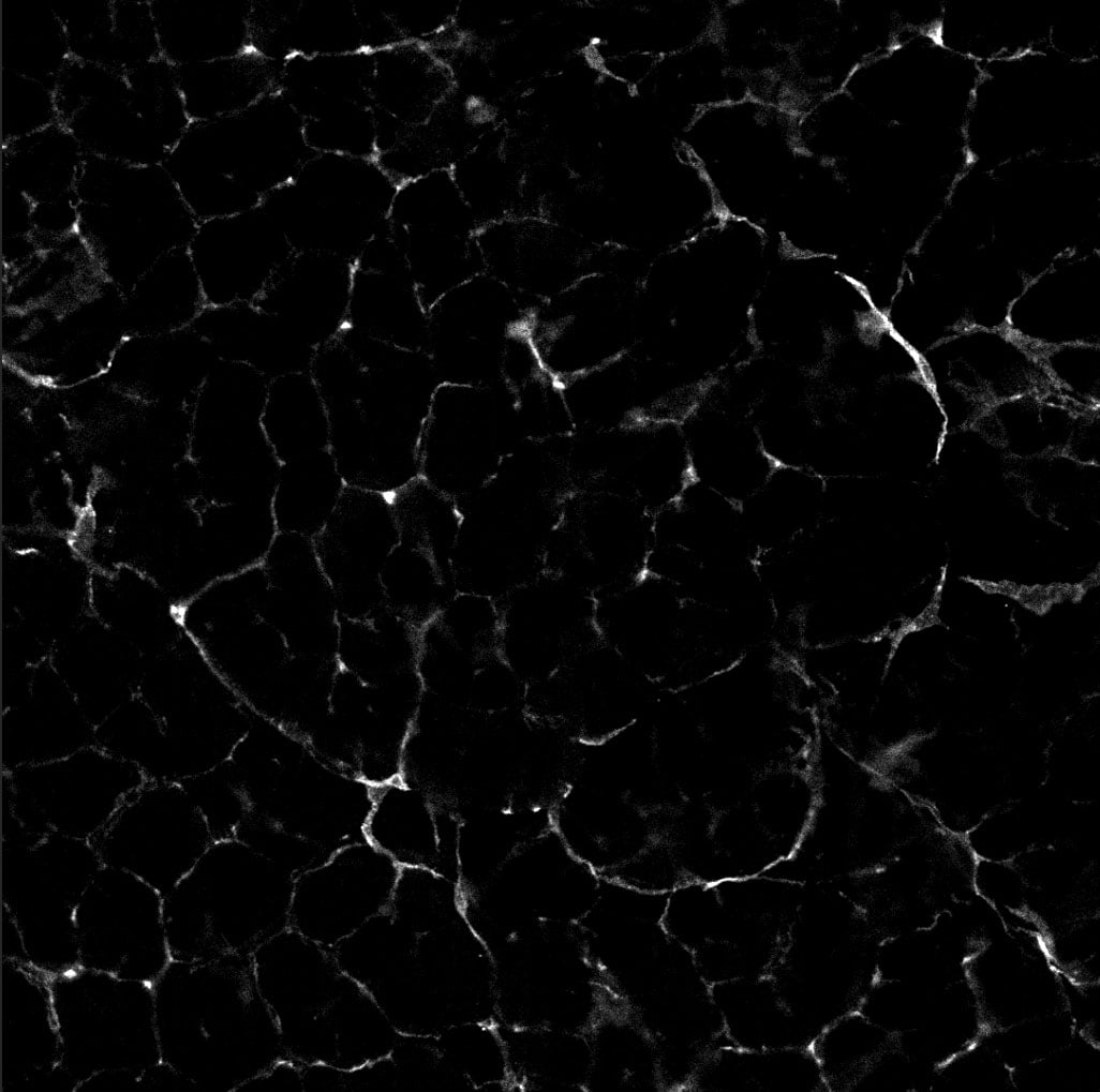 Mouse PDGF R alpha  Antibody AF1062