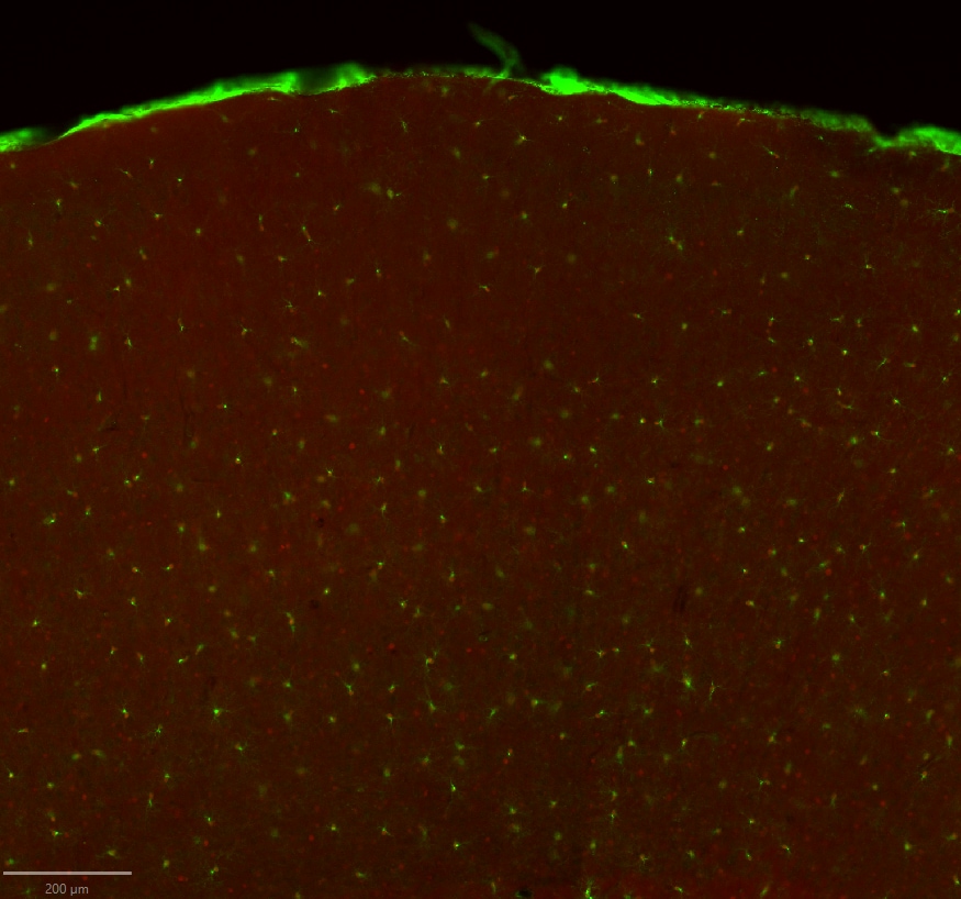 Mouse PDGF R alpha  Antibody AF1062