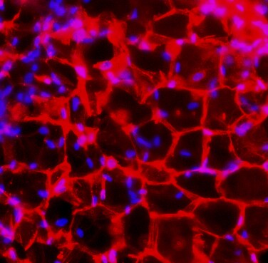 Mouse Resistin Antibody AF1069