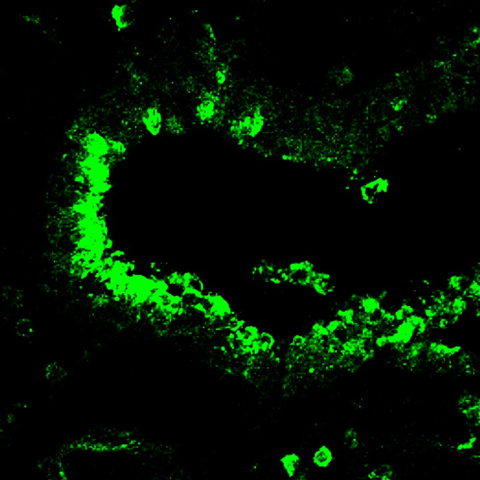 SARS-CoV-2 Spike S2 Subunit Antibody AF10774