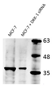 Human/Mouse Dkk‑1 Antibody AF1096