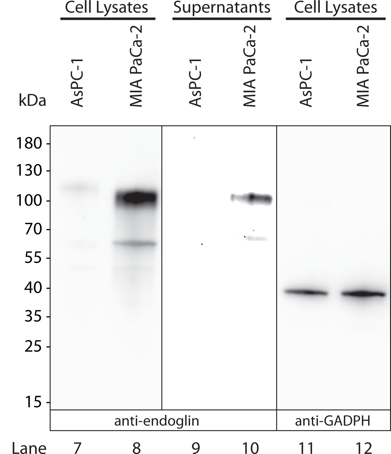 Human Endoglin/CD105 Antibody AF1097