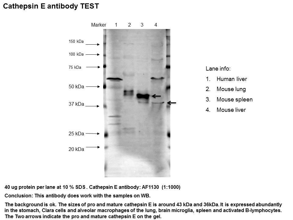 Mouse Cathepsin E Antibody AF1130