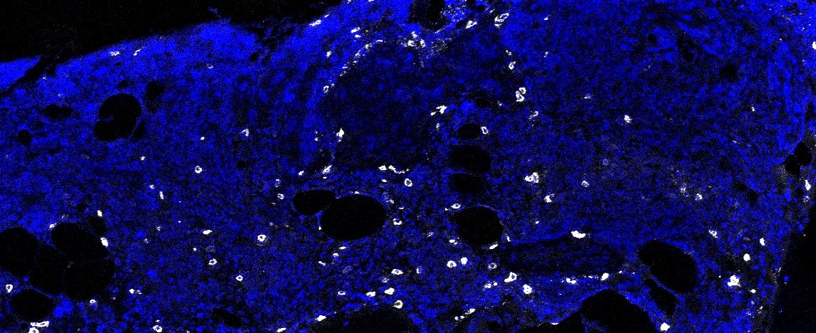 Human Galectin‑3 Antibody AF1154