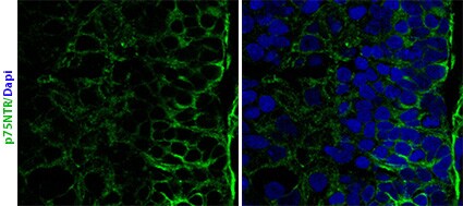 Mouse NGFR/TNFRSF16 Antibody AF1157
