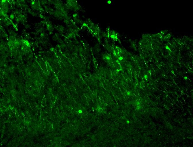 Mouse NGFR/TNFRSF16 Antibody AF1157