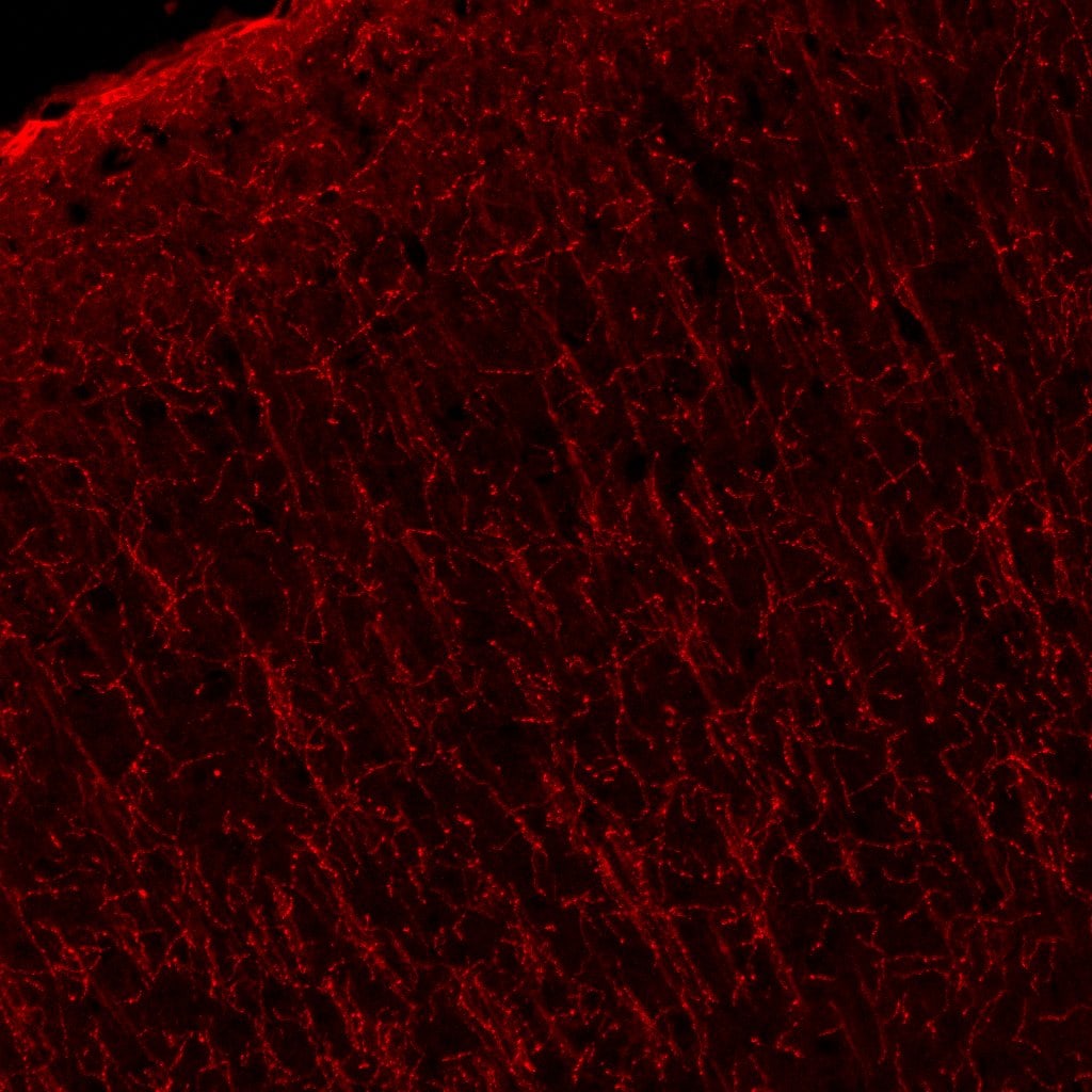 Mouse NGFR/TNFRSF16 Antibody AF1157