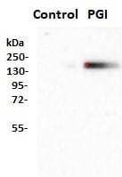 Human DPPIV/CD26 Antibody AF1180