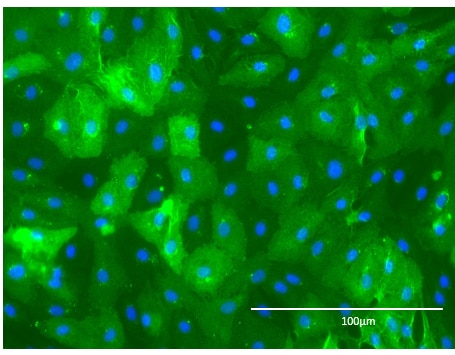 Human DPPIV/CD26 Antibody AF1180