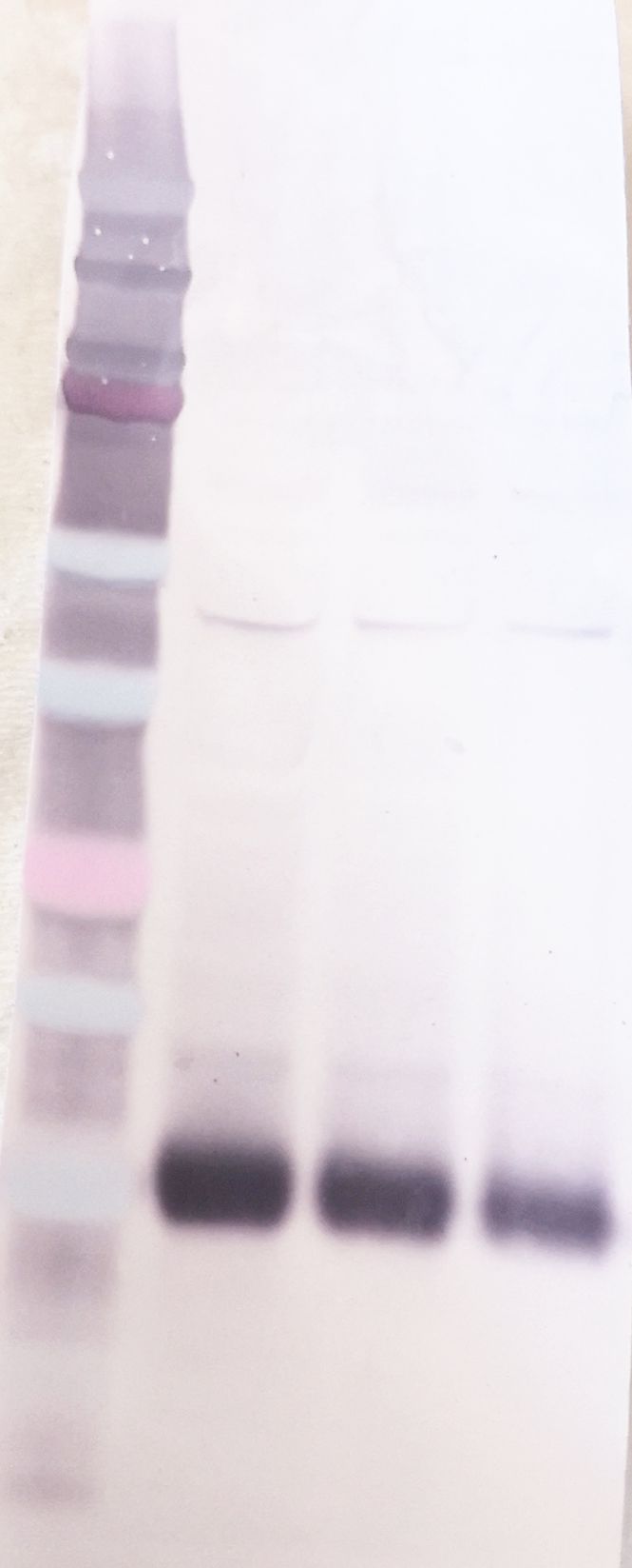 Human Cystatin C Antibody AF1196