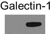 Mouse Galectin‑1 Antibody AF1245