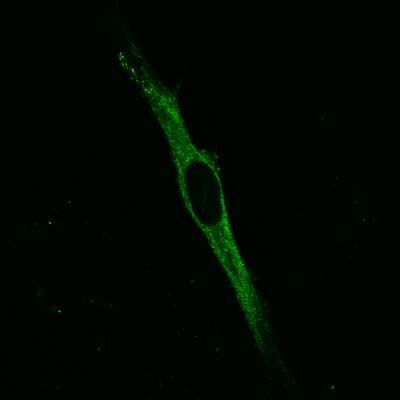 Mouse Galectin‑1 Antibody AF1245