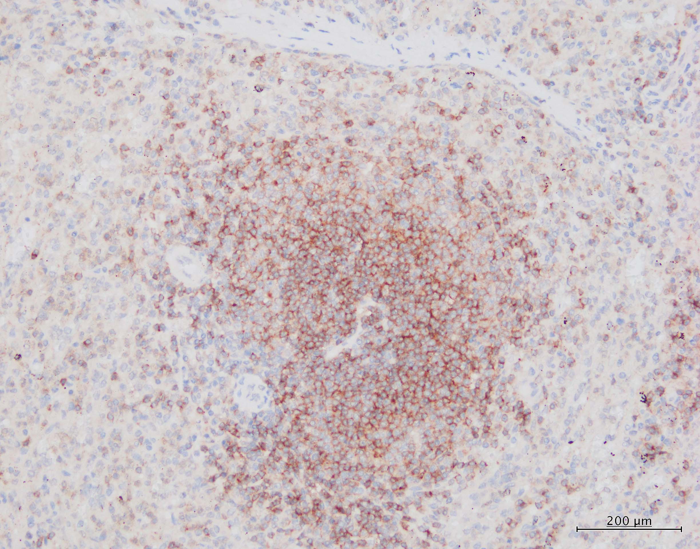 Human BAFF/BLyS/TNFSF13B Antibody AF124