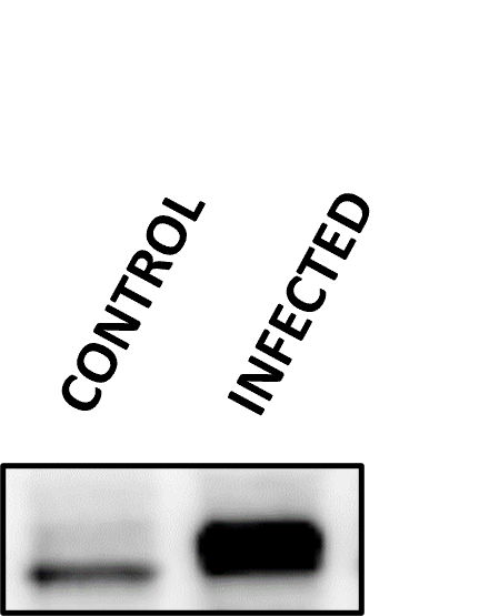 Human u‑Plasminogen Activator (uPA)/Urokinase Antibody AF1310