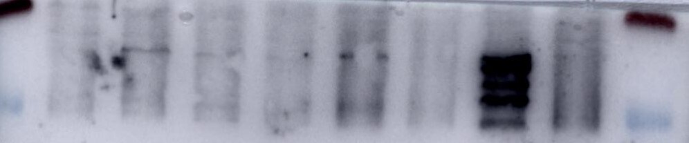 Mouse Endoglin/CD105 Antibody AF1320