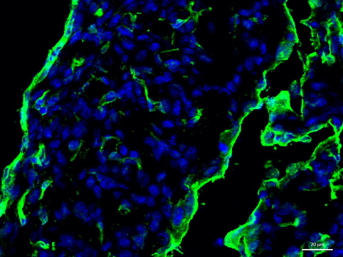 Mouse Endoglin/CD105 Antibody AF1320
