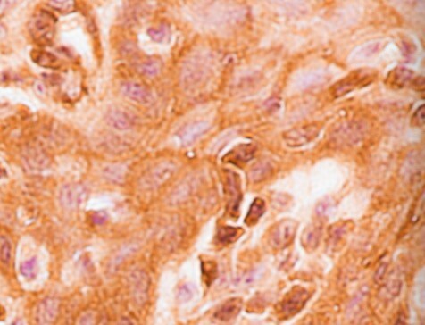 Human/Mouse/Rat beta-Catenin Antibody AF1329