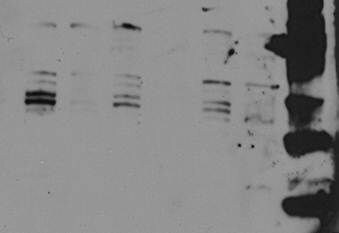 Human Galectin‑7 Antibody AF1339