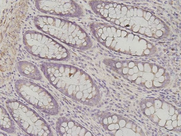Human Galectin‑7 Antibody AF1339