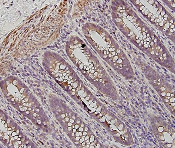 Human Galectin‑7 Antibody AF1339