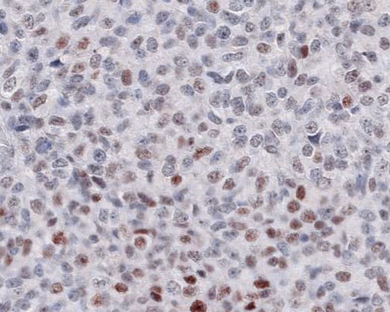 Human/Mouse/Rat p53 Antibody AF1355