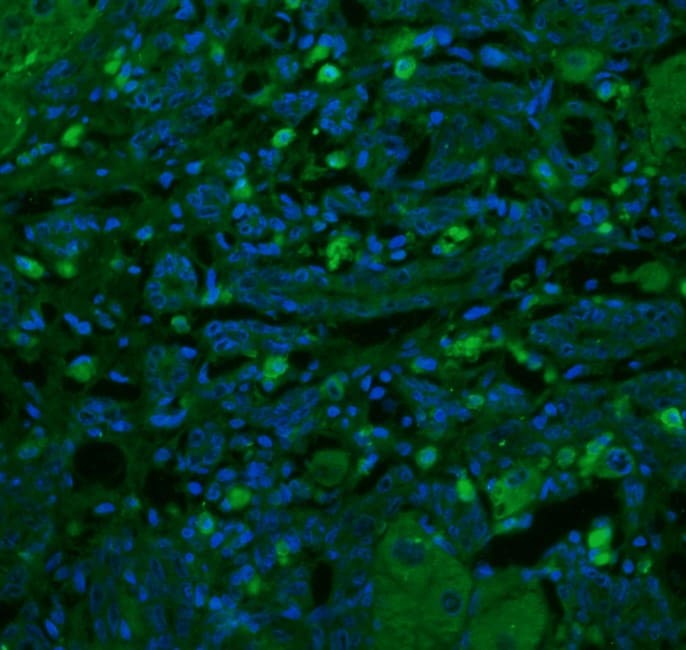 Human/Mouse CD117/c-kit Antibody AF1356