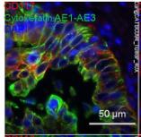 Human/Mouse CD117/c-kit Antibody AF1356